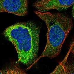 KIAA0753/MNR Antibody, Novus Biologicals 25 &mu;L; Unlabeled:Antibodies,